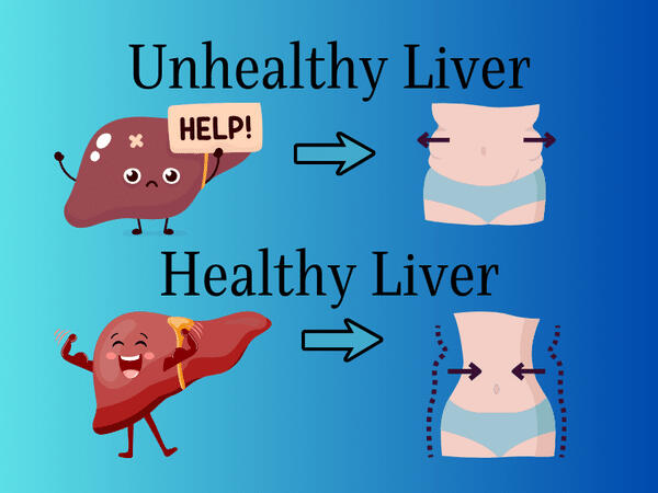 A graphic of an unhealthy and a healthy liver. The unhealthy liver is holding up a Help sign with an arrow pointing to an over weight body. The healthy liver is happy and flexing bicep muscles with an arrow pointing to a healthy and lean body. This graphic